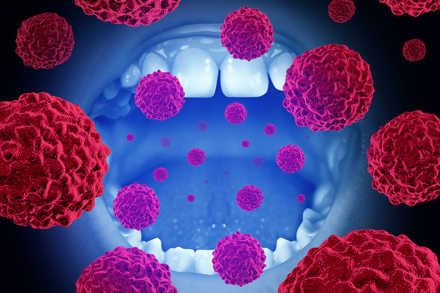 disease_oral